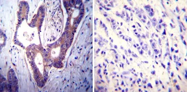 Anti-PMCA ATPase antibody [5F10] used in IHC (Paraffin sections) (IHC-P). GTX22825