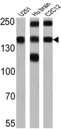 Anti-PMCA ATPase antibody [5F10] used in Western Blot (WB). GTX22825