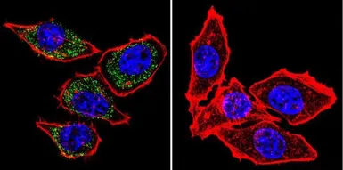 Anti-PMCA ATPase antibody [5F10] used in Immunocytochemistry/ Immunofluorescence (ICC/IF). GTX22825