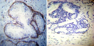 Anti-Sodium/Potassium ATPase alpha 3 antibody [XVIF9-G10] used in IHC (Paraffin sections) (IHC-P). GTX22826