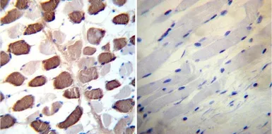 Anti-SERCA2 ATPase antibody [2A7-A1] used in IHC (Paraffin sections) (IHC-P). GTX22861