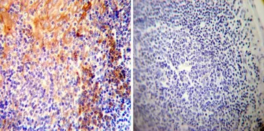 Anti-SERCA2 ATPase antibody [2A7-A1] used in IHC (Paraffin sections) (IHC-P). GTX22861