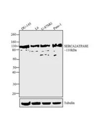 Anti-SERCA2 ATPase antibody [2A7-A1] used in Western Blot (WB). GTX22861