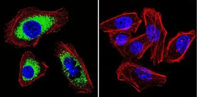 Anti-SERCA2 ATPase antibody [2A7-A1] used in Immunocytochemistry/ Immunofluorescence (ICC/IF). GTX22861