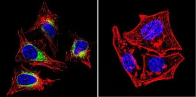 Anti-SERCA2 ATPase antibody [2A7-A1] used in Immunocytochemistry/ Immunofluorescence (ICC/IF). GTX22861