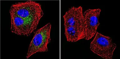 Anti-SERCA2 ATPase antibody [2A7-A1] used in Immunocytochemistry/ Immunofluorescence (ICC/IF). GTX22861