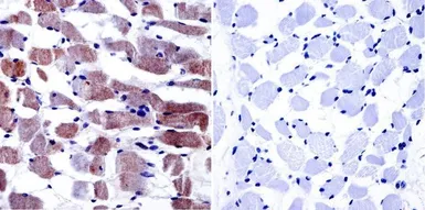 Anti-Cav1.1 antibody [1A] used in IHC (Paraffin sections) (IHC-P). GTX22862