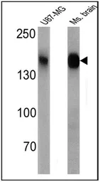 Anti-CACNA2D1 antibody [20A] used in Western Blot (WB). GTX22864