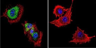 Anti-CACNA2D1 antibody [20A] used in Immunocytochemistry/ Immunofluorescence (ICC/IF). GTX22864