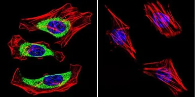 Anti-CACNA2D1 antibody [20A] used in Immunocytochemistry/ Immunofluorescence (ICC/IF). GTX22864