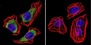 Anti-CACNA2D1 antibody [20A] used in Immunocytochemistry/ Immunofluorescence (ICC/IF). GTX22864