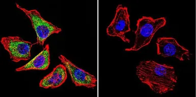 Anti-NCX1 antibody [C2C12] used in Immunocytochemistry/ Immunofluorescence (ICC/IF). GTX22869