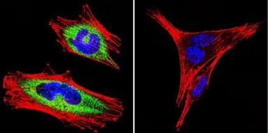 Anti-NCX1 antibody [C2C12] used in Immunocytochemistry/ Immunofluorescence (ICC/IF). GTX22869