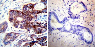 Anti-Sodium/Potassium ATPase alpha 1 antibody [M8-P1-A3] used in IHC (Paraffin sections) (IHC-P). GTX22872