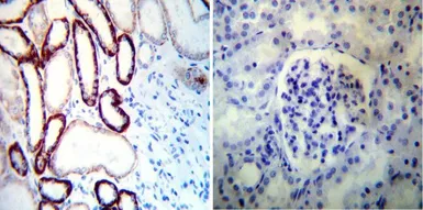 Anti-Sodium/Potassium ATPase alpha 1 antibody [M8-P1-A3] used in IHC (Paraffin sections) (IHC-P). GTX22872