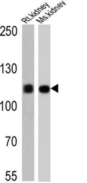 Anti-Sodium/Potassium ATPase alpha 1 antibody [M8-P1-A3] used in Western Blot (WB). GTX22872