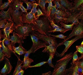 Anti-Sodium/Potassium ATPase alpha 1 antibody [M8-P1-A3] used in Immunocytochemistry/ Immunofluorescence (ICC/IF). GTX22872