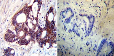 Anti-Sodium/Potassium ATPase beta 1 antibody [M17-P5-F11] used in IHC (Paraffin sections) (IHC-P). GTX22873