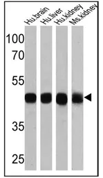 Anti-Sodium/Potassium ATPase beta 1 antibody [M17-P5-F11] used in Western Blot (WB). GTX22873