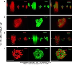 Anti-Filaggrin antibody [FLG01] used in Immunocytochemistry/ Immunofluorescence (ICC/IF). GTX23137