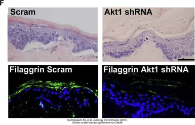 Anti-Filaggrin antibody [FLG01] used in IHC (Frozen sections) (IHC-Fr). GTX23137