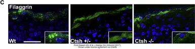 Anti-Filaggrin antibody [FLG01] used in  (). GTX23137