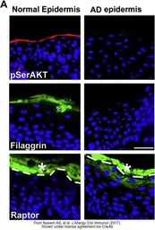 Anti-Filaggrin antibody [FLG01] used in  (). GTX23137