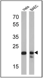 Anti-PSMB6 antibody used in Western Blot (WB). GTX23331