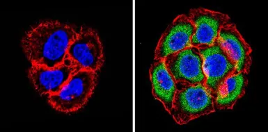 Anti-PSMB6 antibody used in Immunocytochemistry/ Immunofluorescence (ICC/IF). GTX23331