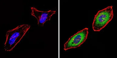 Anti-PSMB6 antibody used in Immunocytochemistry/ Immunofluorescence (ICC/IF). GTX23331