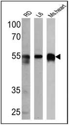 Anti-Calsequestrin antibody used in Western Blot (WB). GTX23516