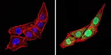 Anti-Calsequestrin antibody used in Immunocytochemistry/ Immunofluorescence (ICC/IF). GTX23516