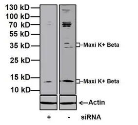 Anti-KCNMB1 antibody used in Western Blot (WB). GTX23587