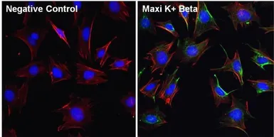 Anti-KCNMB1 antibody used in Immunocytochemistry/ Immunofluorescence (ICC/IF). GTX23587