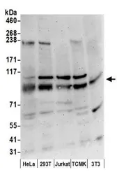 Anti-SERCA2 ATPase antibody used in Western Blot (WB). GTX23625