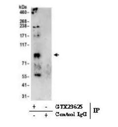 Anti-SERCA2 ATPase antibody used in Immunoprecipitation (IP). GTX23625