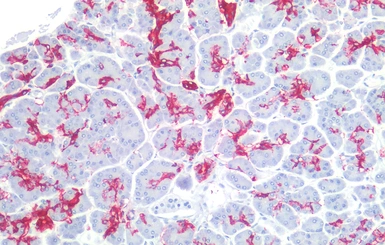 Anti-CA19-9 antibody [121SLE] used in IHC (Paraffin sections) (IHC-P). GTX23982