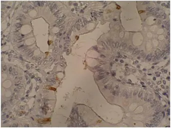 Anti-CA19-9 antibody [121SLE] used in IHC (Paraffin sections) (IHC-P). GTX23982