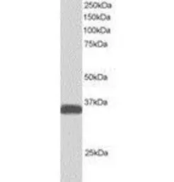 Anti-ALS2CR2 antibody used in Western Blot (WB). GTX24122