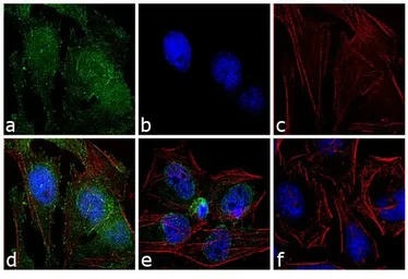 Anti-c-Abl (phospho Tyr245) antibody used in Immunocytochemistry/ Immunofluorescence (ICC/IF). GTX24479