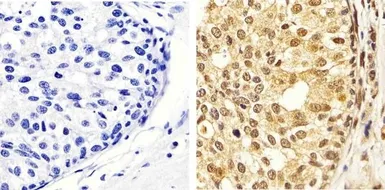 Anti-ERK1 (phospho Thr202/Tyr204) + ERK2 (phospho Thr185/Tyr187) antibody used in IHC (Paraffin sections) (IHC-P). GTX24819