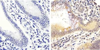 Anti-ERK1 (phospho Thr202/Tyr204) + ERK2 (phospho Thr185/Tyr187) antibody used in IHC (Paraffin sections) (IHC-P). GTX24819
