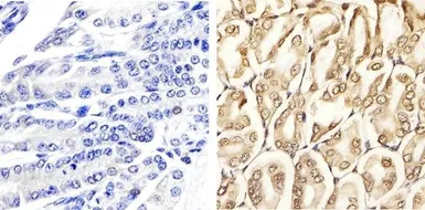 Anti-ERK1 (phospho Thr202/Tyr204) + ERK2 (phospho Thr185/Tyr187) antibody used in IHC (Paraffin sections) (IHC-P). GTX24819