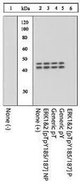 Anti-ERK1 (phospho Thr202/Tyr204) + ERK2 (phospho Thr185/Tyr187) antibody used in Western Blot (WB). GTX24819