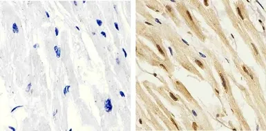 Anti-p38 MAPK (phospho Thr180/Tyr182) antibody used in IHC (Paraffin sections) (IHC-P). GTX24822