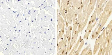 Anti-p38 MAPK (phospho Thr180/Tyr182) antibody used in IHC (Paraffin sections) (IHC-P). GTX24822