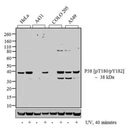 Anti-p38 MAPK (phospho Thr180/Tyr182) antibody used in Western Blot (WB). GTX24822