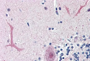 Anti-FOXC1 antibody, C-term used in IHC (Paraffin sections) (IHC-P). GTX25079