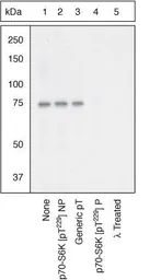 Anti-p70 S6K (phospho Thr229) antibody used in Western Blot (WB). GTX25231