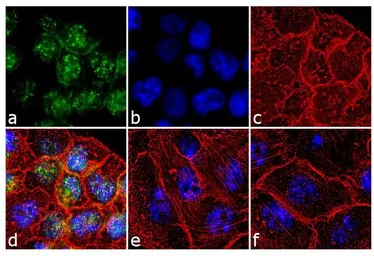 Anti-p70 S6K (phospho Thr229) antibody used in Immunocytochemistry/ Immunofluorescence (ICC/IF). GTX25231